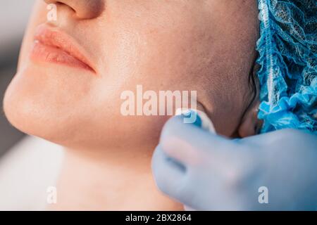 Les injections intradermiques sans douleur et sans danger sont efficaces pour corriger les rides imiques et séniles, y compris les plis du triangle nasolabial Banque D'Images