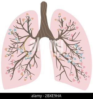 Ballonnements, poumons sains. Journée mondiale contre la pneumonie. La lutte contre la tuberculose en médecine. Les poumons du fumeur et en bonne santé. Poumons roses dedans Illustration de Vecteur