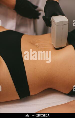 Femme ayant un traitement d'épilation au laser dans un salon de beauté Banque D'Images