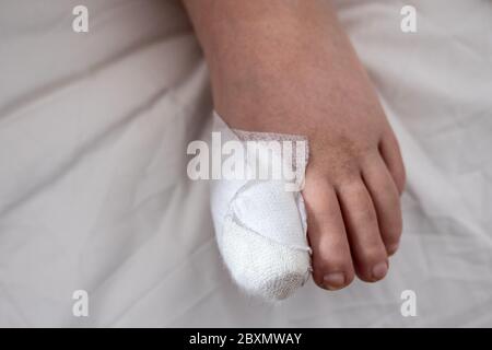 Laura a eu un ongle enlevé et un coupé après trois tentatives infructueuses de faire sortir les ongles du pied. L'opération a pris 2 heures. Banque D'Images