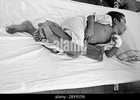 Hôpital d'urgence, Battambang, Cambodge, Asie, effets des mines terrestres Banque D'Images