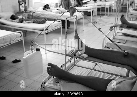 Hôpital d'urgence, Battambang, Cambodge, Asie, effets des mines terrestres Banque D'Images