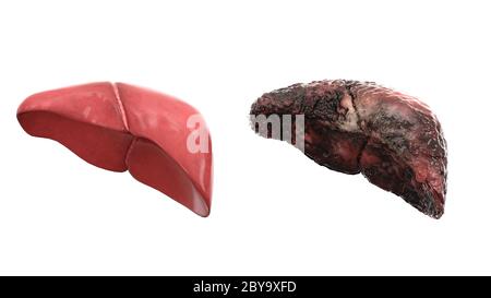 foie sain et maladie foie sur isolat blanc. Concept médical d'autopsie. Cancer et problème de tabagisme. rendu 3d Banque D'Images