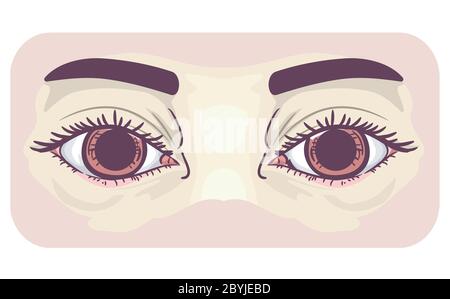 Illustration des yeux avec des pupilles dilatées, symptôme de mydriase Banque D'Images