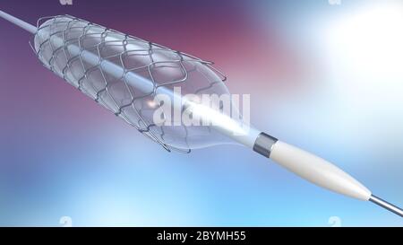 3d illustration de cathéter pour l'implantation de l'endoprothèse pour soutenir la circulation du sang dans les vaisseaux sanguins Banque D'Images