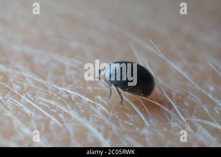 Super gros plan macro de sang rempli de tiques mâles noires de couleur gris foncé (Ixodes ricinus) rampant sur la peau humaine. Banque D'Images