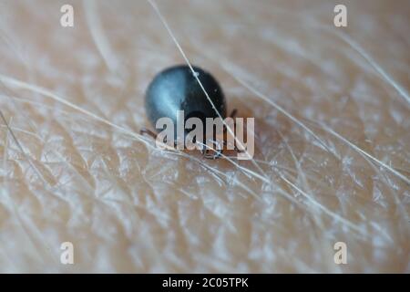 Super gros plan macro de sang rempli de tiques mâles noires de couleur gris foncé (Ixodes ricinus) rampant sur la peau humaine. Banque D'Images