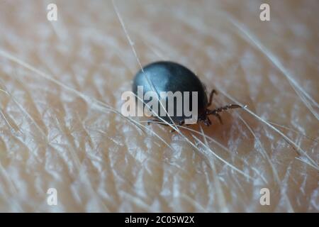 Super gros plan macro de sang rempli de tiques mâles noires de couleur gris foncé (Ixodes ricinus) rampant sur la peau humaine. Banque D'Images