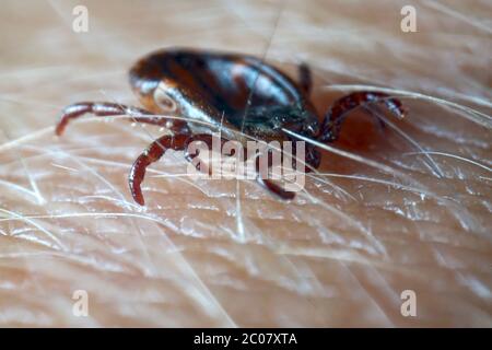 Macro gros plan de l'rampement parasite Dermacentor reticulatus rampant sur la peau humaine. Également connu sous le nom de tique de vache ornée, tique de chien ornée, tique de prairie, Banque D'Images