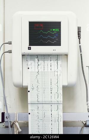 Gros plan d'un moniteur fœtal ou d'un test de non-stress pour l'impression de battements cardiaques, d'électrocardiographes et de contractions utérines de la mère dans la salle de travail et d'accouchement Banque D'Images