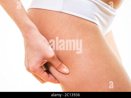 Woman la cellulite sur les fesses Banque D'Images