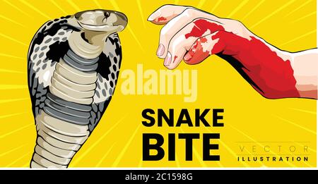 Serpent morsure sur le bras Cobra morsure serpent homme main besoin de premiers soins et dangereux Illustration de Vecteur