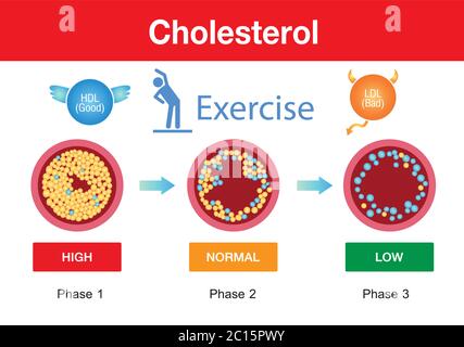 Cholestérol dans l'artère, risque pour la santé, exercice, conception de vecteur Illustration de Vecteur