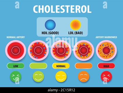 Cholestérol dans l'artère, risque pour la santé, conception de vecteur Illustration de Vecteur