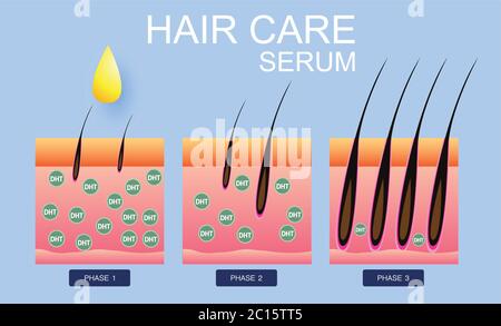 Sérum de soins capillaires, transplantation de cheveux, conception vectorielle Illustration de Vecteur