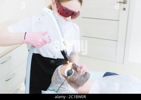 La fille de cosmétique en lunettes de protection fait la procédure de décollement du carbone avec l'aide d'un laser de cosmologie. Écaillage du visage en carbone Banque D'Images