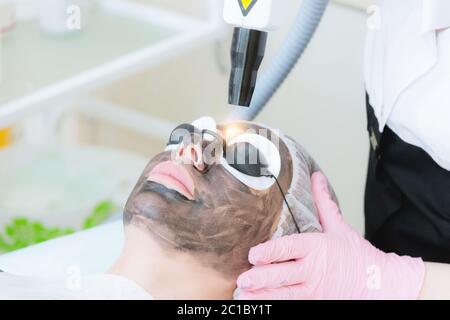 Procédure de décollement du visage en carbone gros plan. Les impulsions laser nettoie la peau du visage. Traitement de cosmologie matérielle. Processus de photothe Banque D'Images