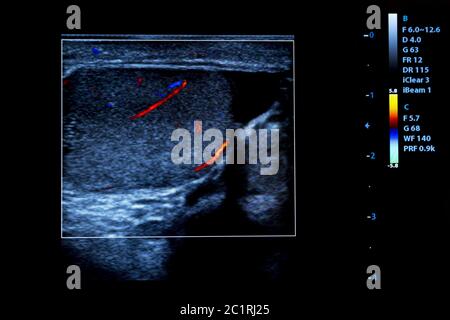 L'image moderne de couleur moniteur échographie Banque D'Images