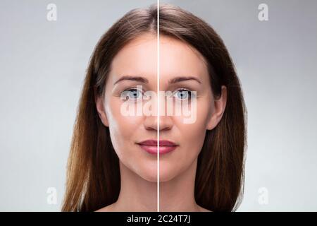 Close-up of a young woman's Face avant et après intervention cosmétique Banque D'Images