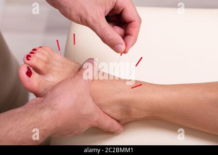 Femme l'objet d'un traitement d'Acupuncture avec de fines aiguilles dans la peau de son pied Banque D'Images