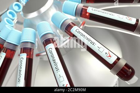 Coronavirus, groupe de virus qui causent des maladies chez les mammifères et les oiseaux. Chez l'homme, le virus cause des infections respiratoires. Illustration tridimensionnelle. Banque D'Images