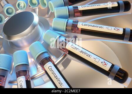 Coronavirus, groupe de virus qui causent des maladies chez les mammifères et les oiseaux. Chez l'homme, le virus cause des infections respiratoires. Illustration tridimensionnelle. Banque D'Images