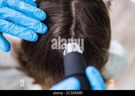 Close-up de l'aide de dermatologues Trichoscope pour sa Clinique de traitement Chute des cheveux Banque D'Images