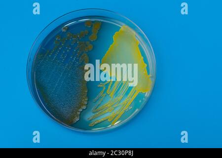 Boîte de Pétri avec bactéries sur fond bleu. Bactéries Staphylococcus aureus et pseudomonas aeruginosa sur gélose au milieu Banque D'Images