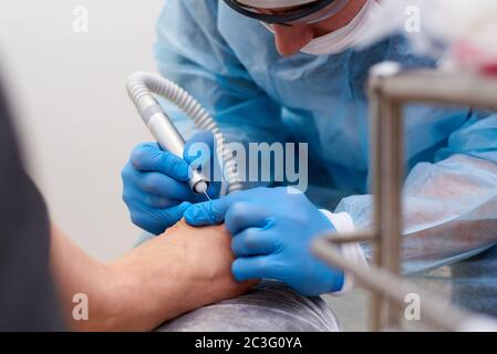 Traitement des maladies fongiques de la peau des pieds et des ongles. Banque D'Images