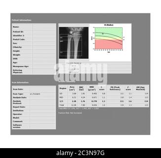 DEXA rapport de densitométrie de l'examen des articulations du poignet lombaire pour Osteopenia présent, précurseur fréquent de l'ostéoporose. Banque D'Images