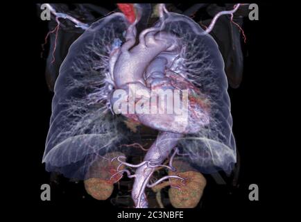 CTA poitrine avec Lung 3D rendu image montrant le coeur, poumon et os tramsparent. Banque D'Images