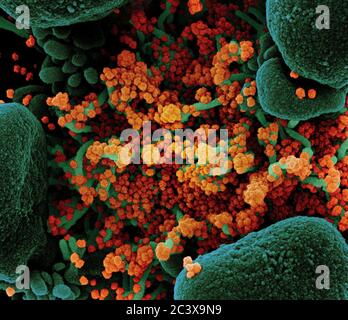 Nouveau coronavirus SRAS-COV-2 Micrographe électronique à balayage colorisé d'une cellule apoptotique (verte) fortement infectée par des particules du virus SRAS-COV-2 (orange), isolée d'un échantillon de patient. Image au Centre de recherche intégré (IRF) du NIAID à fort Detrick, Maryland. Banque D'Images