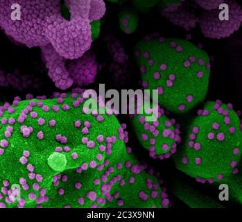 Nouveau coronavirus SRAS-COV-2 Micrographe électronique à balayage colorisé d'une cellule apoptotique (verte) fortement infectée par des particules du virus SRAS-COV-2 (violette), isolée d'un échantillon de patient. Image au Centre de recherche intégré (IRF) du NIAID à fort Detrick, Maryland. Banque D'Images