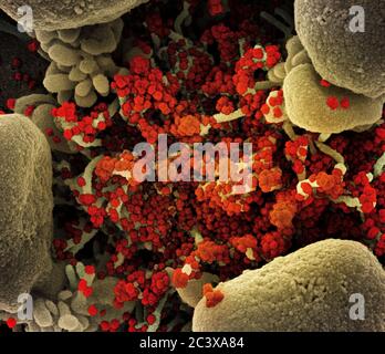 Nouveau coronavirus SRAS-COV-2 Micrographe électronique à balayage colorisé d'une cellule apoptotique (verte) fortement infectée par des particules du virus SRAS-COV-2 (orange), isolée d'un échantillon de patient. Image au Centre de recherche intégré (IRF) du NIAID à fort Detrick, Maryland. Banque D'Images