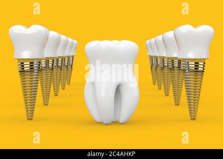 Dent saine prémolaire entre les rangées d'implants de dents sur fond jaune. Rendu 3d Banque D'Images