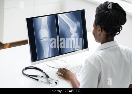 Chirurgien Docteur regardant l'examen des os de rayons X du genou à l'aide de la technologie logicielle Banque D'Images