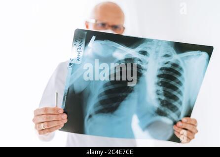 Médecin de sexe masculin examinant le film radiographique thoracique du patient, scanner les poumons au service de radiologie de l'hôpital.Covid-19 scanner le test de radiographie du corps pour détecter la présence de la wor covid Banque D'Images