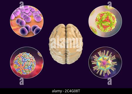 Infections cérébrales. Illustration informatique des micro-organismes qui causent l'encéphalite et la méningite. Banque D'Images