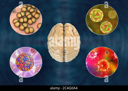 Infections cérébrales. Illustration informatique des micro-organismes qui causent l'encéphalite et la méningite. Banque D'Images