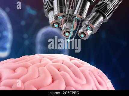 Cerveau humain avec une puce implantée. Rendu 3D. Banque D'Images