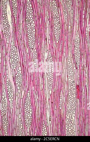Ilex aquafolia Linn, détail de tige Holly, photomicrographe à fond clair Banque D'Images