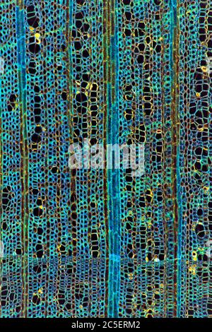 Photomicrographe à fond noir, montrant la structure cellulaire de la tige, Ilex aquafolia Linn, Holly Banque D'Images