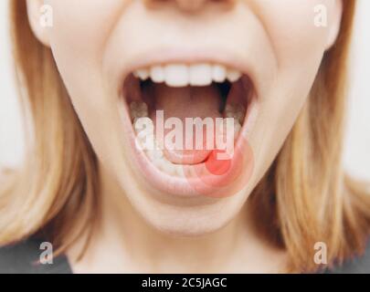 Portrait de femme avec la bouche ouverte pendant la période des checkup chez le dentiste. Banque D'Images