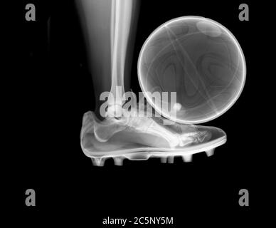 Pied dans l'action coup de pied d'un football, X-ray. Banque D'Images