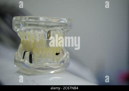 Faites une maquette d'un échantillon de la mâchoire supérieure et inférieure dans le cabinet du dentiste Banque D'Images