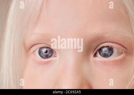 photo en gros plan des yeux d'enfant albinos, petite fille avec des yeux, des cheveux, des sourcils et des cils inhabituels couleur. beauté naturelle, concept albinisme Banque D'Images