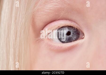 gros plan photo mystique de l'œil d'enfant albino, petite fille avec une couleur inhabituelle des yeux. beauté naturelle, concept albinisme Banque D'Images