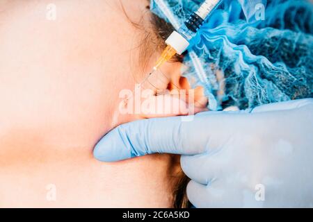 Mandibloplastie non chirurgicale - les coins de la mandibule - indolore et sûr injections intradermiques sont efficaces pour corriger le mimic et le wri sénile Banque D'Images