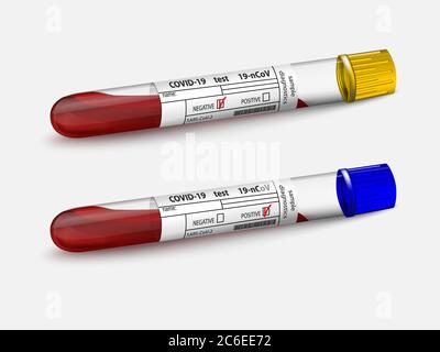 Échantillon de sang dans deux tubes à essai en verre. Test Covid-19. Résultats positifs et négatifs SARS-COV-2. Isolé sur blanc. Analyse du coronavirus. Test sanguin. Illustration de Vecteur