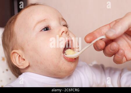 Peu de nouveau-né à bébé, avec une éruption cutanée, dermatite enfant symptôme Problème fessier, les nouveau-nés souffrant de symptômes sur la peau atopique. concept enfant healt Banque D'Images